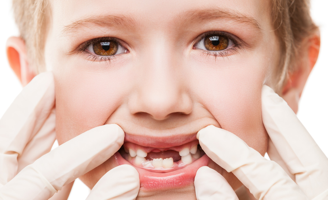 Çocuk Diş Hekimliği ( Pedodonti )